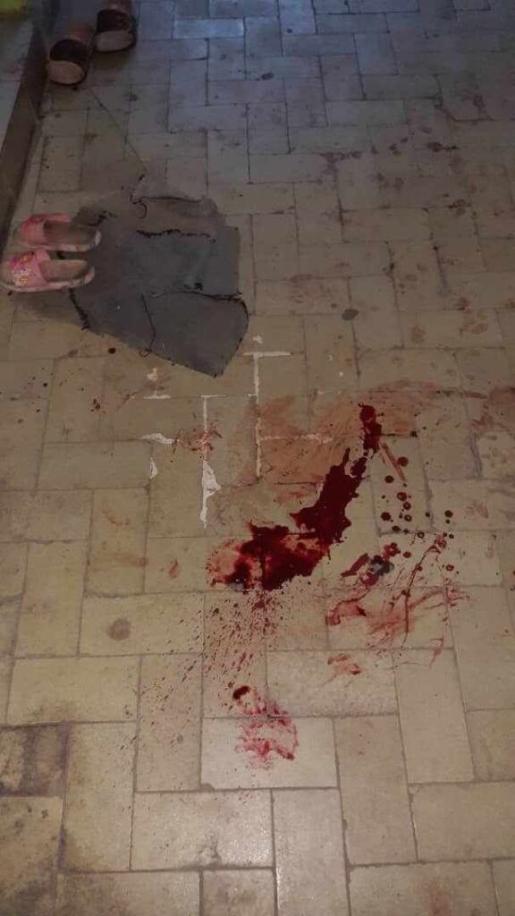 Douala: PO!GNARDÉE DANS SON SOMMEIL PAR SA SŒUR QU'ELLE AVAIT DEMANDER À QUITTER SA MAISON.