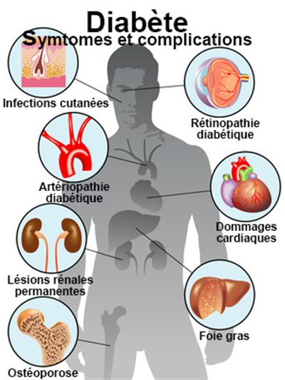 Le Diabète : Une Approche Médicale et Spirituelle