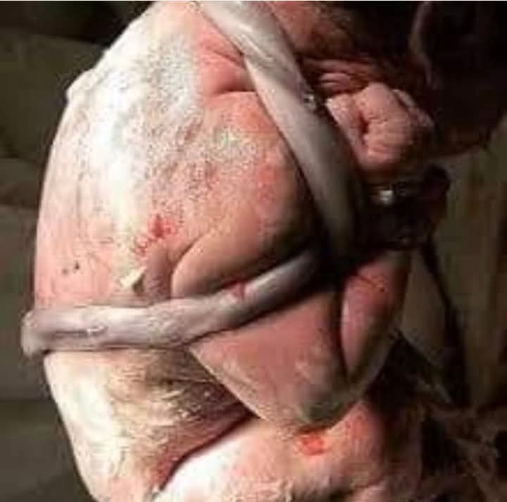 Le Cordon Ombilical Enroulé : Entre Mystères et Sagesse Divine dans la Naissance