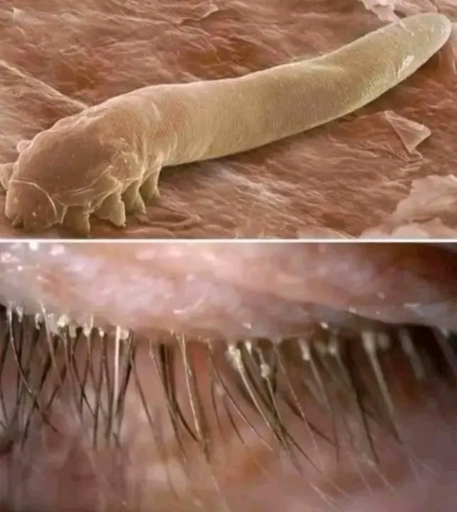 Santé: L’acarien Demodex, ce colocataire invisible de tes cils