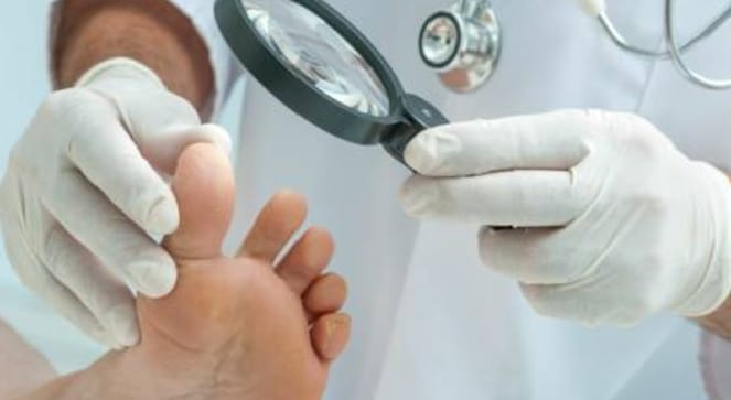 Les ongles sous le microscope : révélateurs de santé et pathologies fréquentes