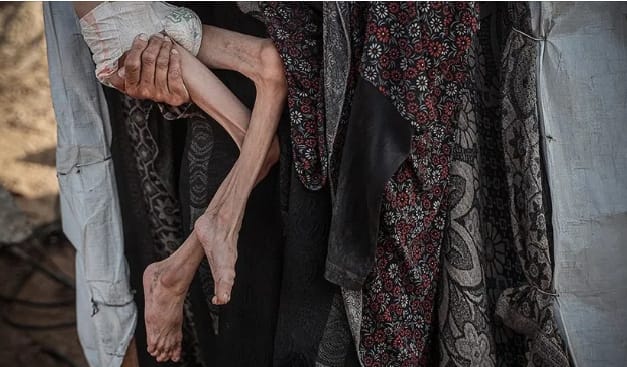 Gaza face à la famine : 455 morts, une crise humanitaire sans précédent