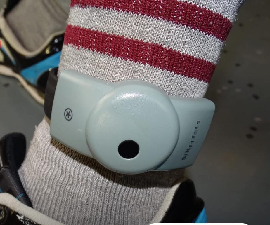 Bracelet électronique : entre modernité judiciaire et soupçon de privilège