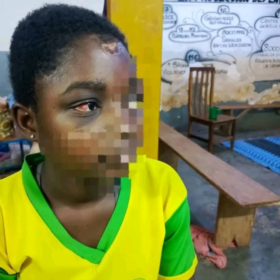 Burkina Faso : une femme interpellée pour maltraitance sur une adolescente de 15 ans.