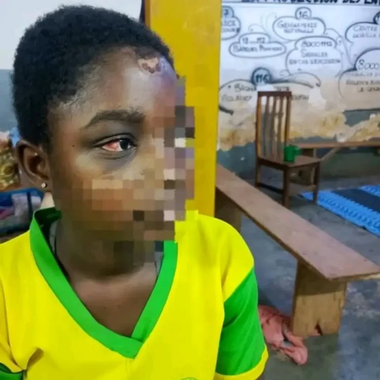 Burkina Faso : une femme interpellée pour maltraitance sur une adolescente de 15 ans.