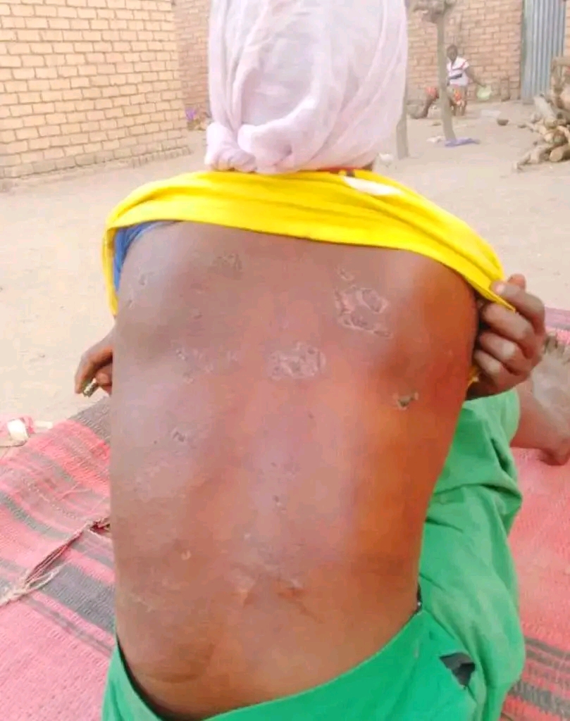 Tchad : battue pour avoir refusé un mariage forcé, une adolescente de 17 ans voulait simplement aller à l’école