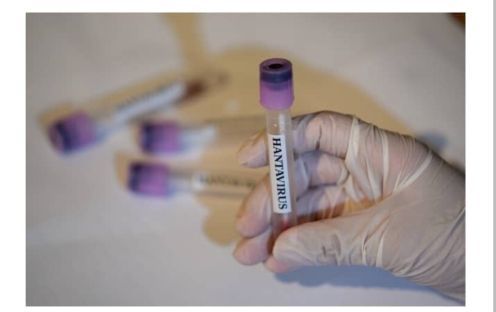 États-Unis: Le CDC active ses centres d’urgence et place l’épidémie de hantavirus au niveau d’alerte 3