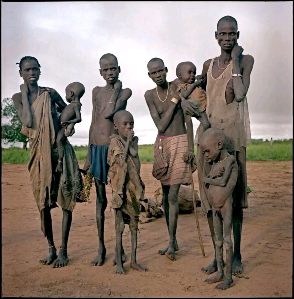 Soudan du Sud : l’effondrement du système de santé fait craindre une catastrophe humanitaire majeure