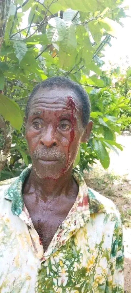 Côte d’Ivoire : un conflit foncier vire à l’agression à la machette à Gbloalé (Logoualé).