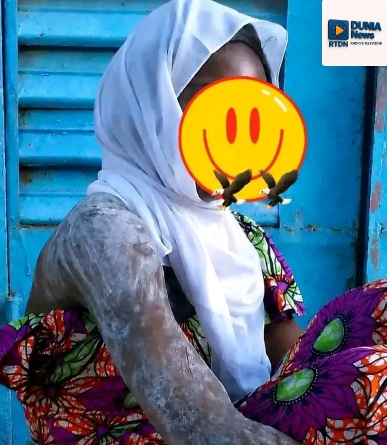 Tchad : Une agente recenseuse grièvement brûlée à Doba lors d'une opération du RGHP3, une enquête ouverte