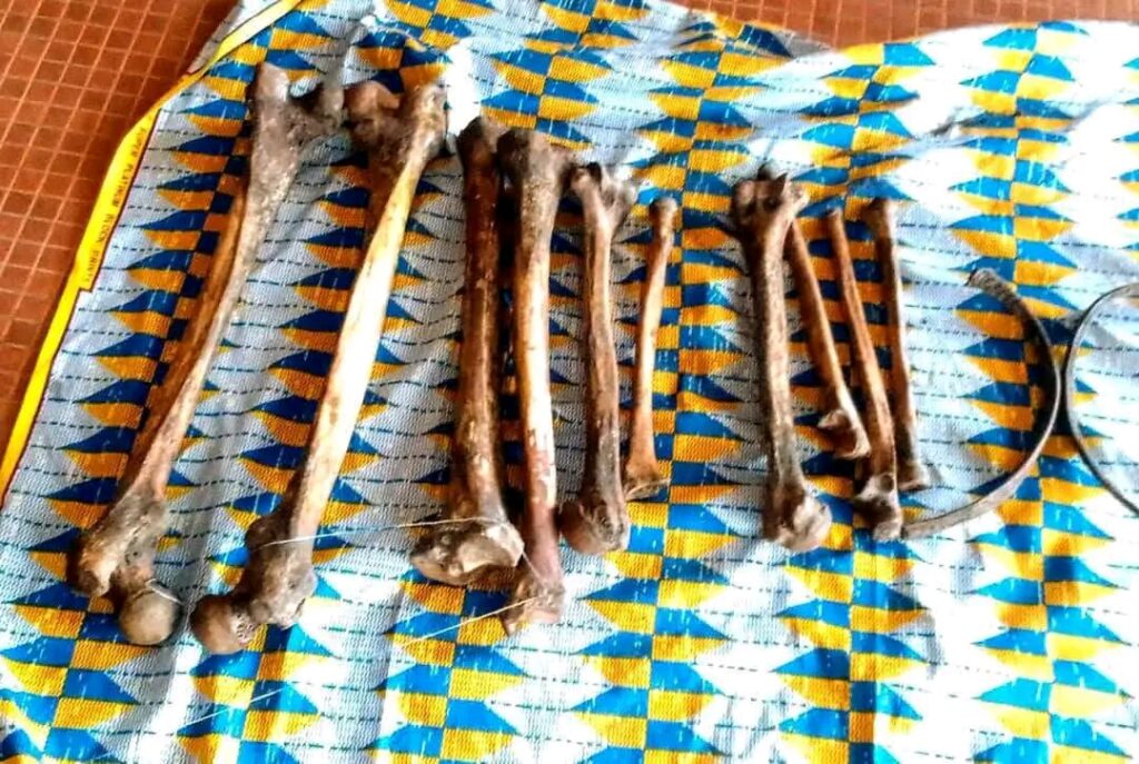 Gabon : Un homme arrêté à Oyem avec un squelette humain, une enquête ouverte pour profanation de sépulture et trafic de restes humains.