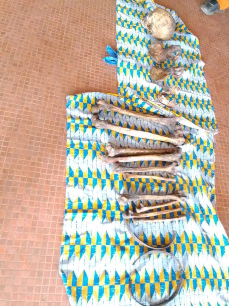 Gabon : Un homme arrêté à Oyem avec un squelette humain, une enquête ouverte pour profanation de sépulture et trafic de restes humains.