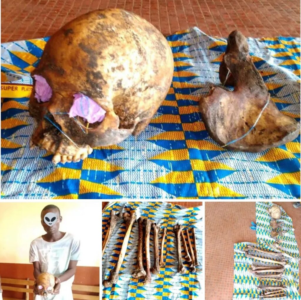 Gabon : Un homme arrêté à Oyem avec un squelette humain, une enquête ouverte pour profanation de sépulture et trafic de restes humains.