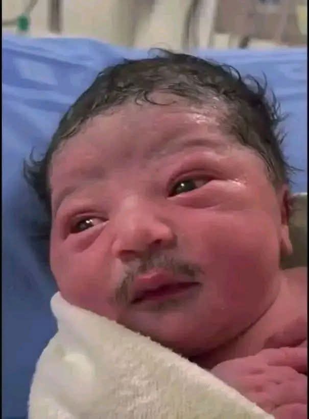 Équateur : le personnel médical intrigué après la naissance d'un bébé portant des moustaches Équateur : le personnel médical intrigué après la naissance d'un bébé portant des moustaches